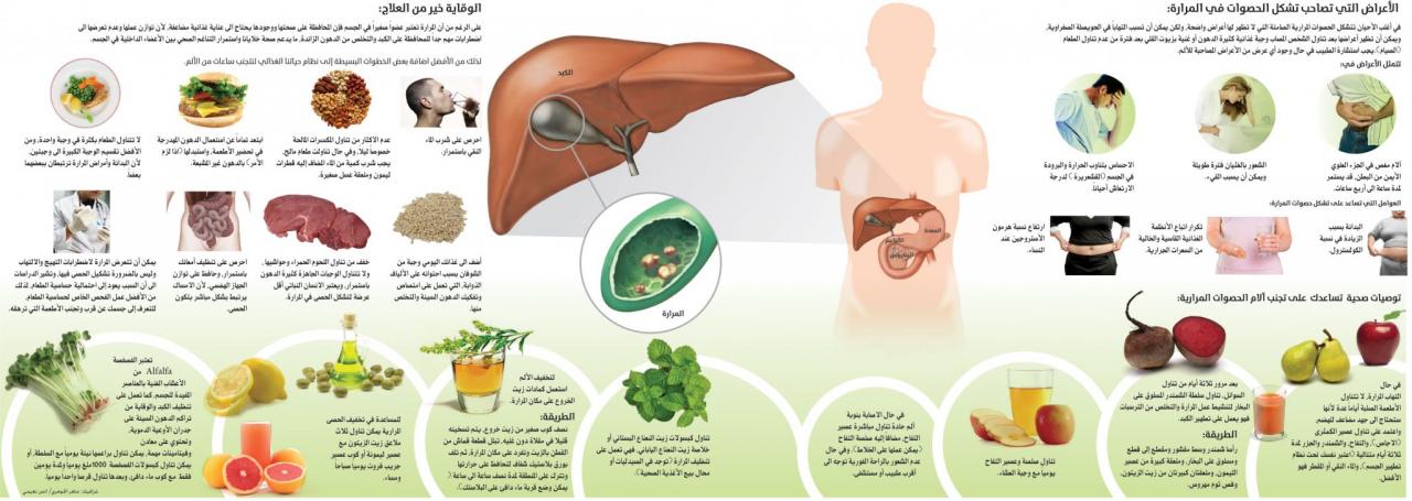 كيف اتخلص من حصى المرارة دون جراحة ، علاج حصوات المرارة الصغيرة 12079