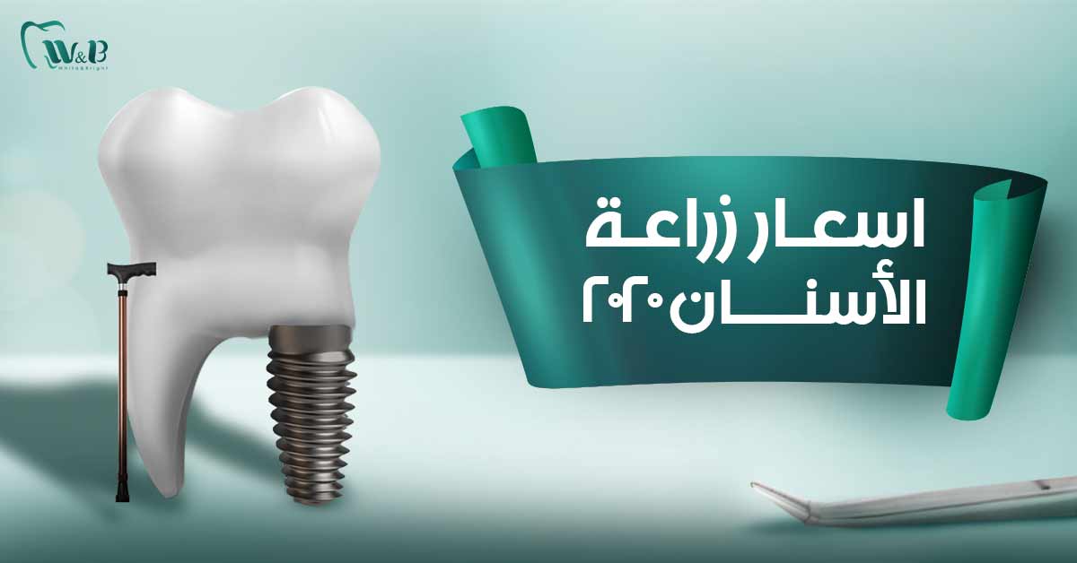 اسعار زراعة الضرس - سعر زراعة الضرس عند الطبيب 14142 3