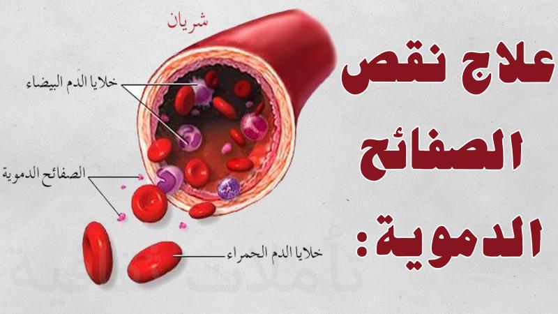 علاج نقص الصفائح الدموية - طريقه التخلص من خطر نقص الصفائح الدمويه 14183 2