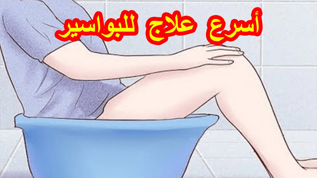 علاج للبواسير الملتهبه , التخلص من البواسير بدون جراحه