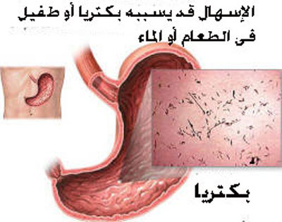 اسباب الاسهال عند الكبار - اسباب تعرض الكبار لاعرض الاسهال 11814