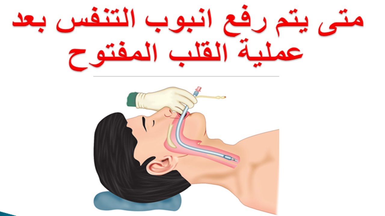 نصائح بعد عملية القلب المفتوح - العنايه الكامله بعد عمليه القلب المفتوح 11459 7